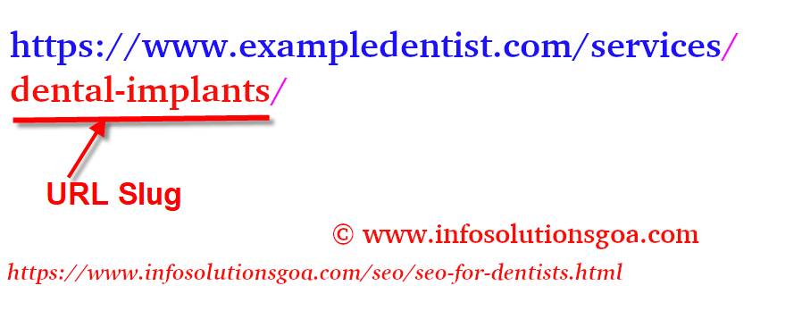Dental Implants page URL